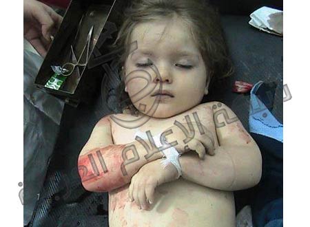 دختر بچه زیبای فلسطینی که توسط صهیونیست ها شهید شد