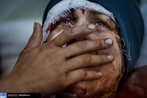 جنگ داخلی در سوریه هم در یک سال گذشته عکاسان را با موقعیت های عجیب و دردناکی مواجه کرده است. در این تصویر هم چهره مجروح و دردمند آیدا، که در جریان یک حمله موشکی همسر و دو فرزندش کشته شدند به سوژه دوربین رودریگو آبد آرژانتینی تبدیل شده است.