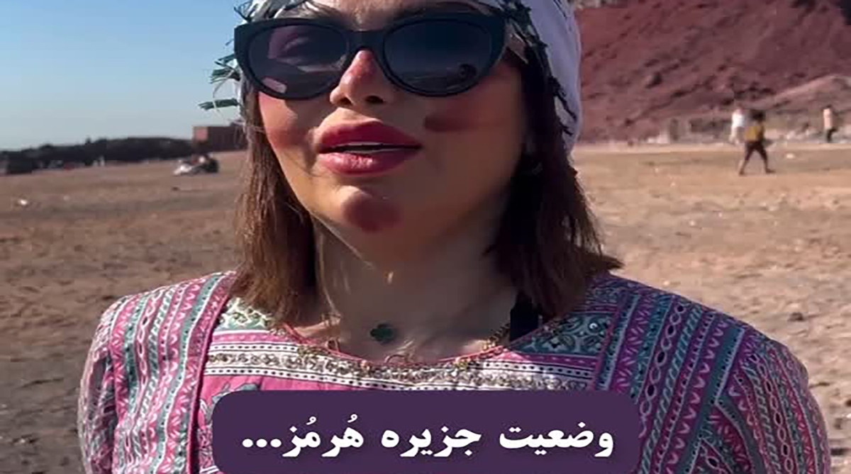 وضعیت تکان‌دهنده ساحل سرخ جزیره هرمز