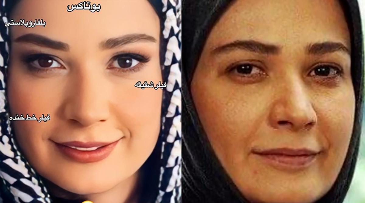 چگونه فهیمه در پایتخت 7 جوان‌تر از پایتخت 6 شد؟!