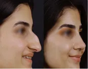 بینی اصیل ایرانی؛ وقتی دیگر خبری از نماد ایرانی بودن نیست!
