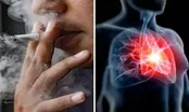 سیگار  چه تاثیری بر چهره و بدن افراد می گذارد؟
