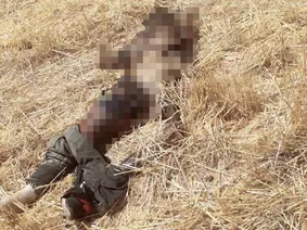 ماجرای جسدی که توسط حیوانات خورده شد