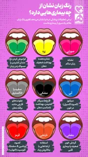 رنگ زبان شما درباره سلامتی‌تان چه می‌گوید؟