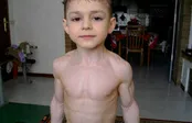 جهش ژنتیکی که حجم عضلات را افزایش می‌دهد