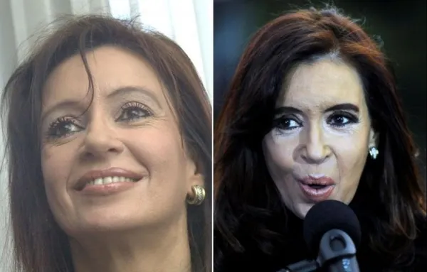کریستینا فرناندز
زمانی که از کریستینا فرناندز، رئیس جمهور آرژانتین دربارۀ ظاهر و جراحی زیبایی سوال کردند او گفت: من همیشه مراقب ظاهرم بودم. رئیس جمهور آرژانتین همواره در مقابل پرسش خبرنگاران و ارائه جزئیات مقاومت کرده است.