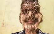 لالیت، پسری با صورت گرگ‌ها