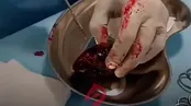 تصاویر تبدیل خرمالو به توده؛ مراقب باشید!
