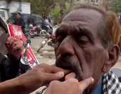 دندان پزشکی کثیف در پاکستان