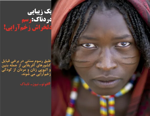 طبق رسوم سنتی در برخی قبایل کشورهای آفریقایی از جمله بنین و اتیوپی زنان و مردان از کودکی زخم&zwnj;آرایی می شوند.
