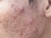 شش محصول آرایشی که هرگز نباید به صورت‌ مالید