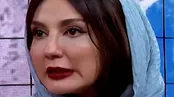 شدت تغییر چهره خانم بازیگر