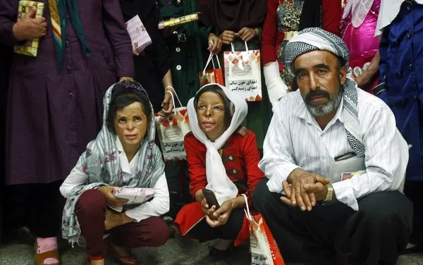 عکس یادگاری در حاشیه اهدای خون والدین شین آبادی ها.والدین کودکان شین آباد به مناسبت بازگشایی مدارس روز (یکشنبه) با حضور در سازمان مرکزی انتقال خون، خون اهدا کردند./IRNA
