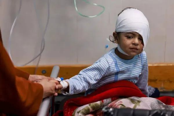 خان یونس، غزه
یک کودک فلسطینی مجروح از اردوگاه جبلیه پس از انتقال از بیمارستان اندونزی در شمال به بیمارستان النصر در خان یونس روی تخت نشسته است.