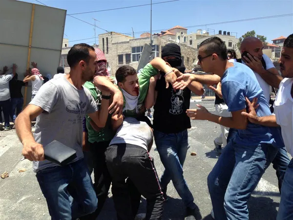 یک نوجوان فلسطینی که به ضرب گلوله صهیونیستها در شرق بیت المقدس  شدیداً مجروح شده است./NBC NEWS
