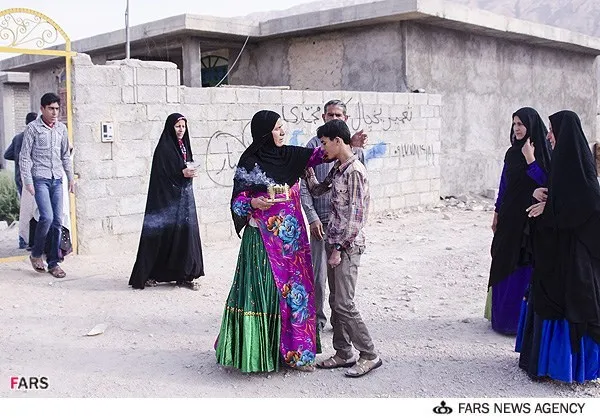 بدرقه سید علی حسینی یکی از سه جوان در روستای دارالمیزان شهرستان مهر در استان فارس مبتلا به بیماری نادر پوستی