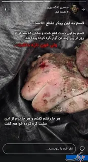تصویر مشت گره‌کرده شهید تنگسیری در لحظه شهادت