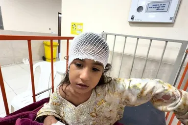 عکس: کودکان مجروح حمله موشکی امریکا به منطقه مسکونی در سیریک ‌