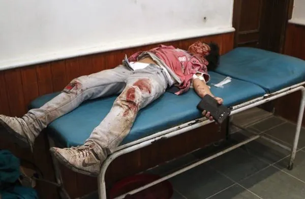 پسرک با جراحت عمیق به دلیل اصابت راکت ارتش سوریه به مواضع تروریست&zwnj;ها در شهر حلب. تروریست&zwnj;های تکفیری در این شهر در میان مردم پنهان شده &zwnj;و همواره با &zwnj;سپرهای انسانی،  عملیات ارتش سوریه &zwnj;علیه خود را دفع می&zwnj;کنند.
